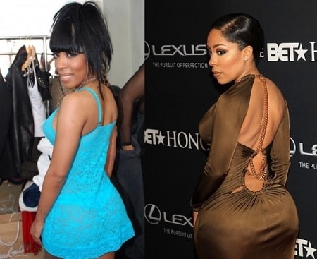 A before and after buttocks surgery picture of K. Michelle.